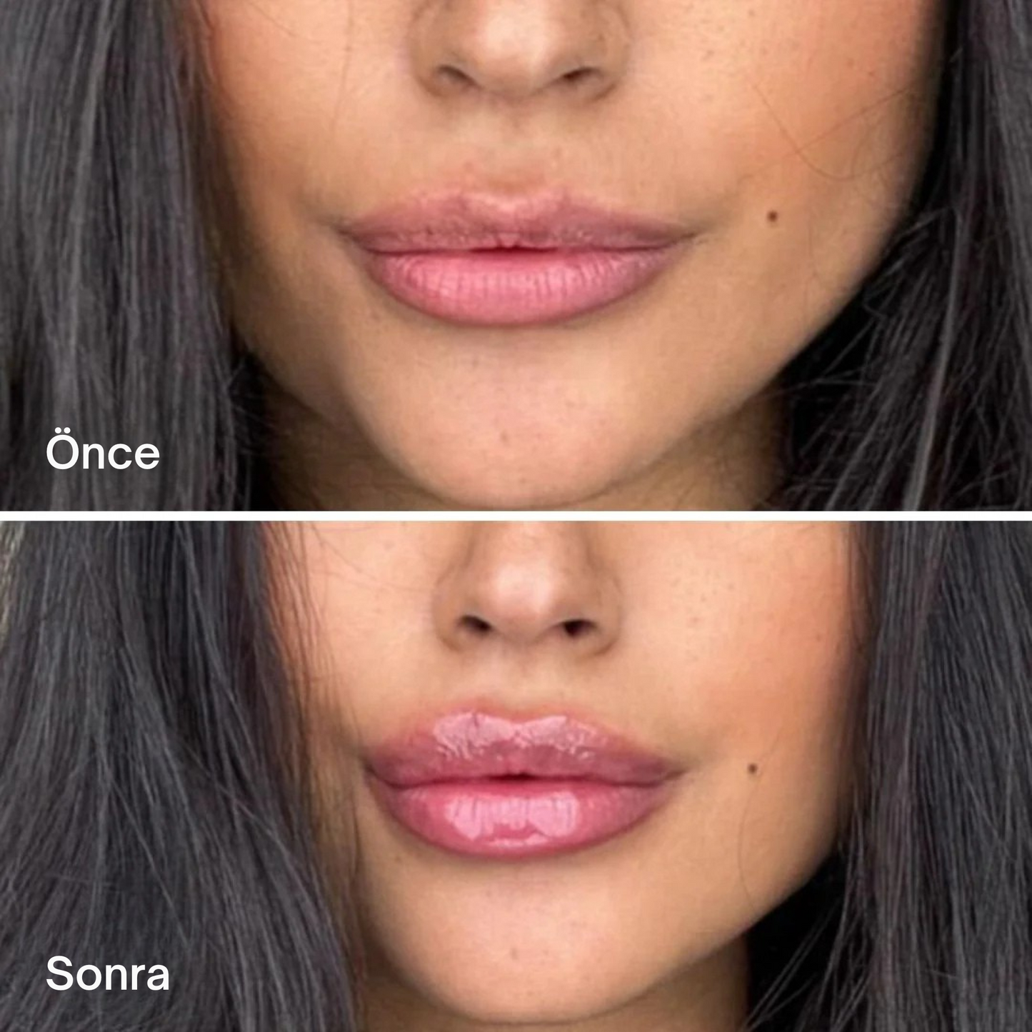 LIP PLUMPER Volumizer